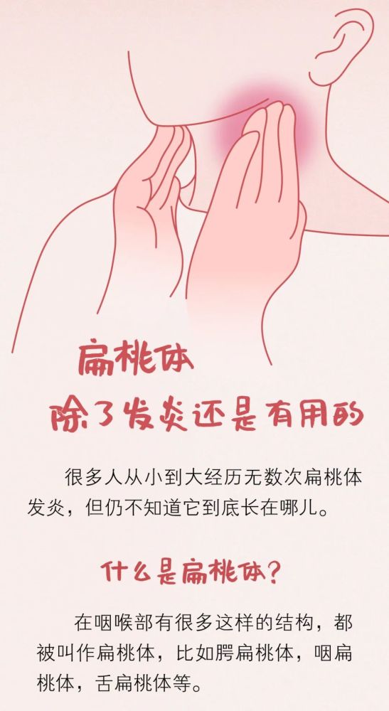 为什么扁桃体总是发炎，什么是扁桃体？(图2)