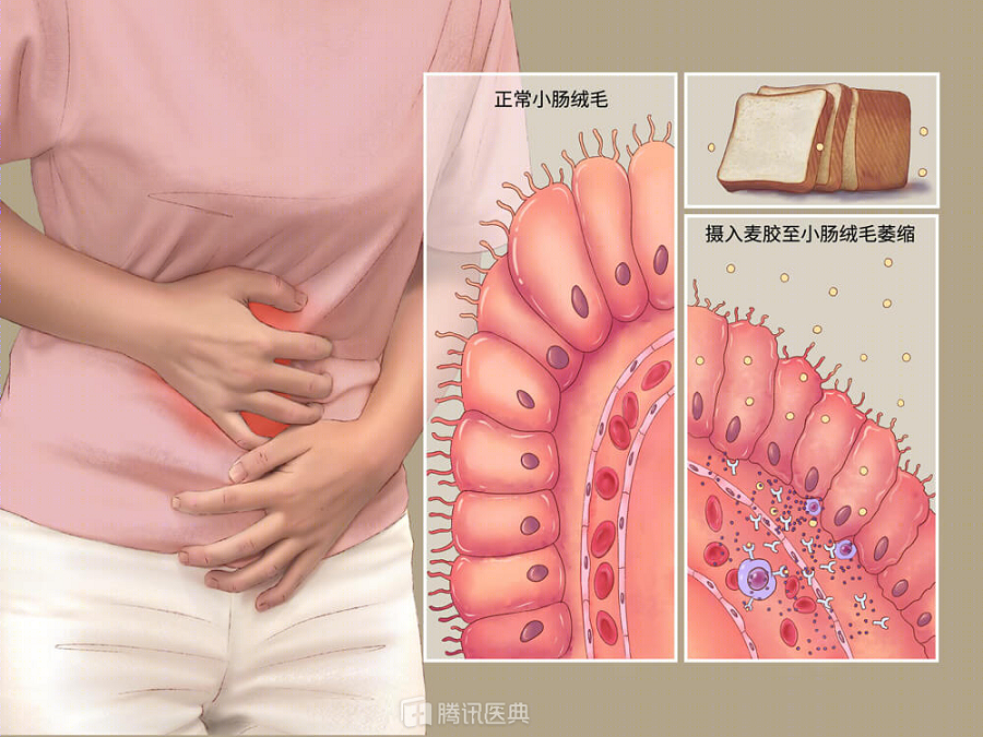 彩虹云商城24小时在线自助下单平台,大便粘马桶是肠癌前兆吗？(图4)